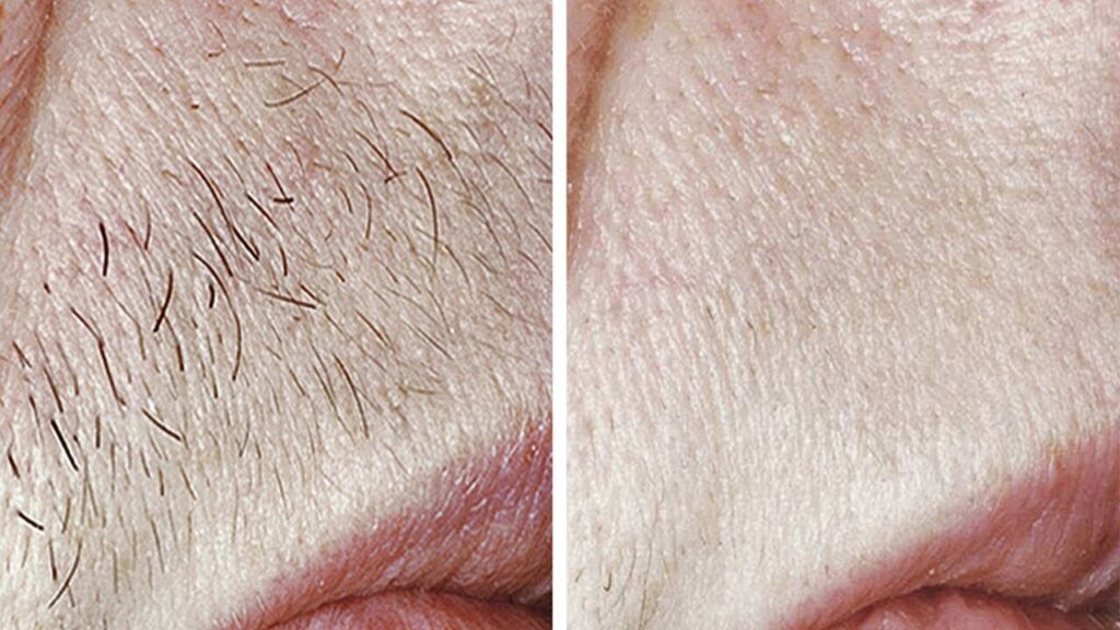 maxresdefault-1-1-1-1